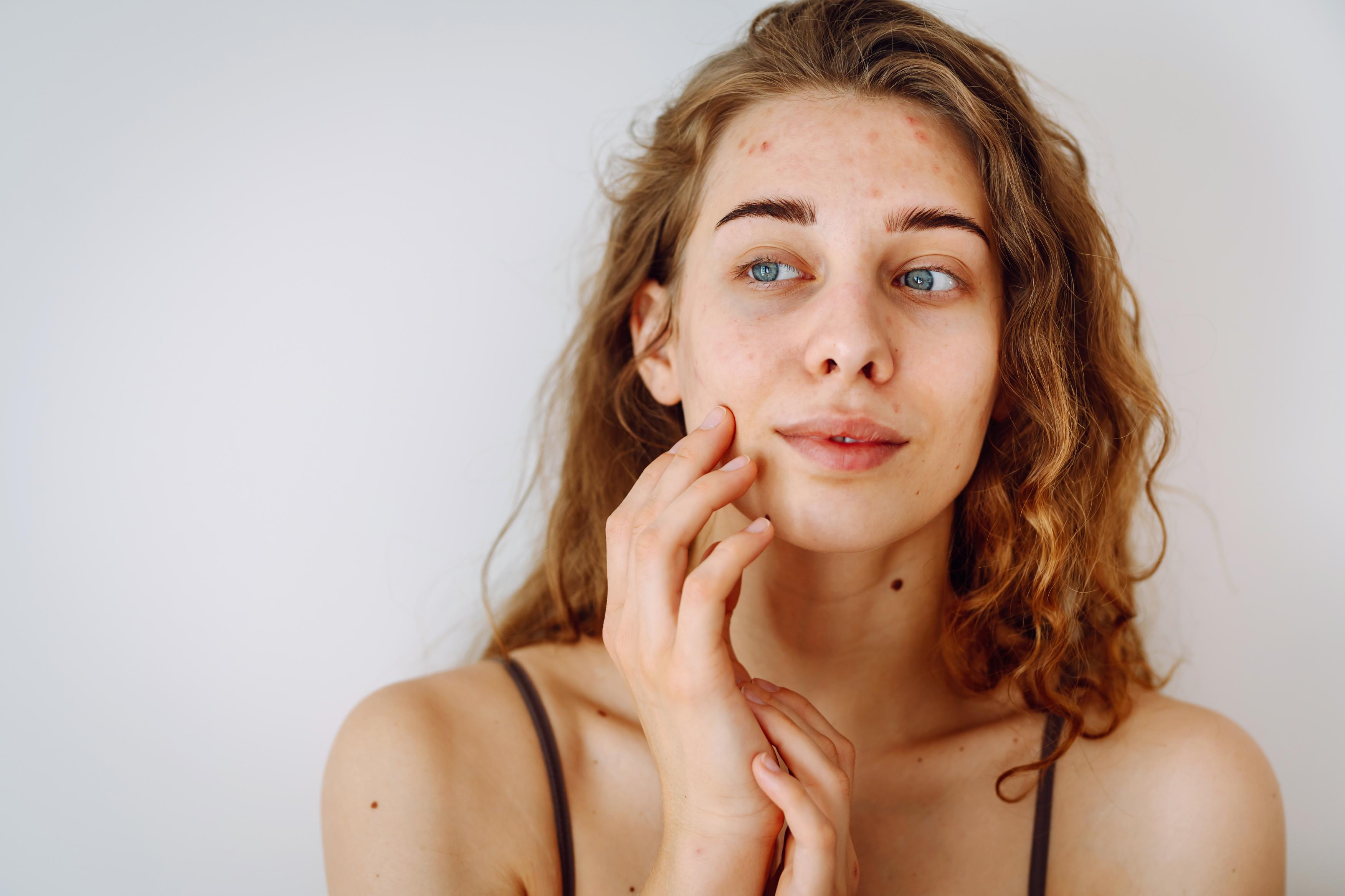 Blonde woman touching her face