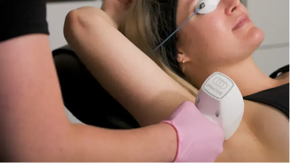 How Does Laser Hair Removal Work?