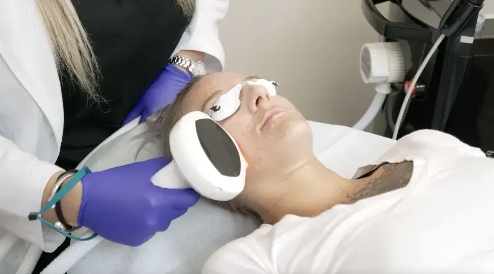 Lumecca IPL for Sun-Damaged Skin: Reversing Summer’s Effects